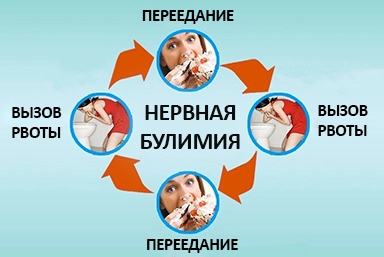 Лечение булимии в Среднеуральске
